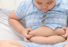 La obesidad infantil y adolescente se cuadruplica y ya afecta a 170 millones de jóvenes en el mundo